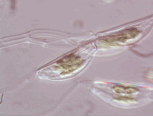 Cymbella (Diatom) 