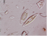 Naviculla (Diatom) 
