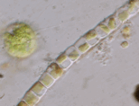 Golenkinia (Green Alga) & Cyclotella (Diatom) 